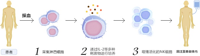 細(xì)胞免疫治療流程