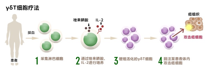 γδT細胞療法