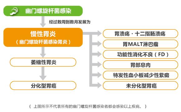 幽門螺旋桿菌