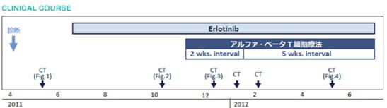 EGFR陽性晚期肺癌選擇免疫細胞療法自救